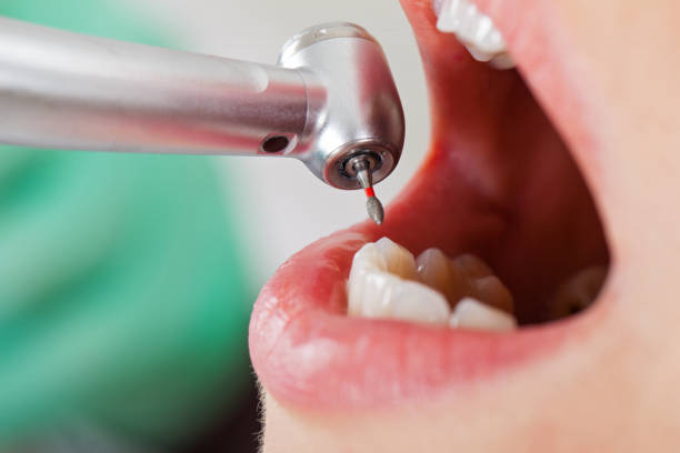 Best Same-Day Emergency Dental Services in Thomas, OK